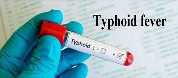 GHS Deploys Rapid Response Team as Typhoid Cases Rise in Oti Region